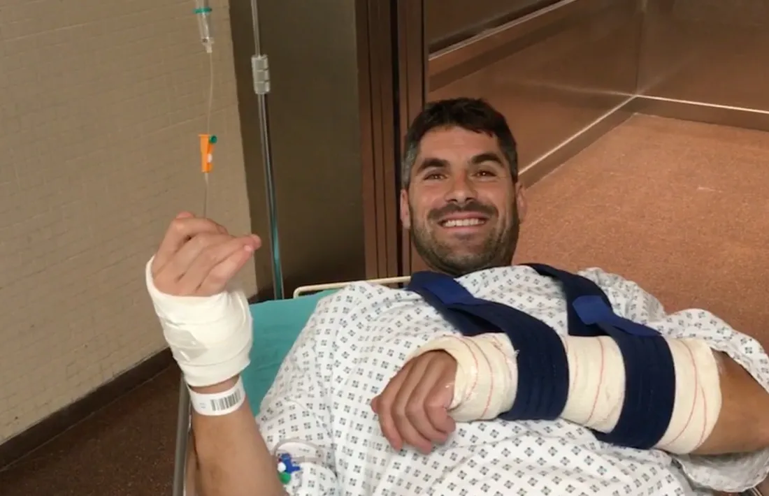 Cristian España es fractura el radi de la mà esquerra