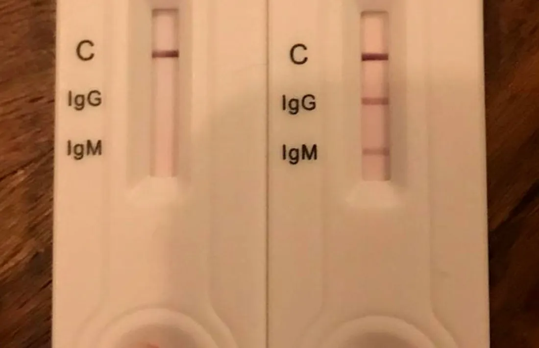 Testos ràpids IgG-IgM.