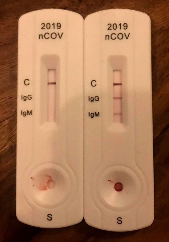 iggigm-covid19-test