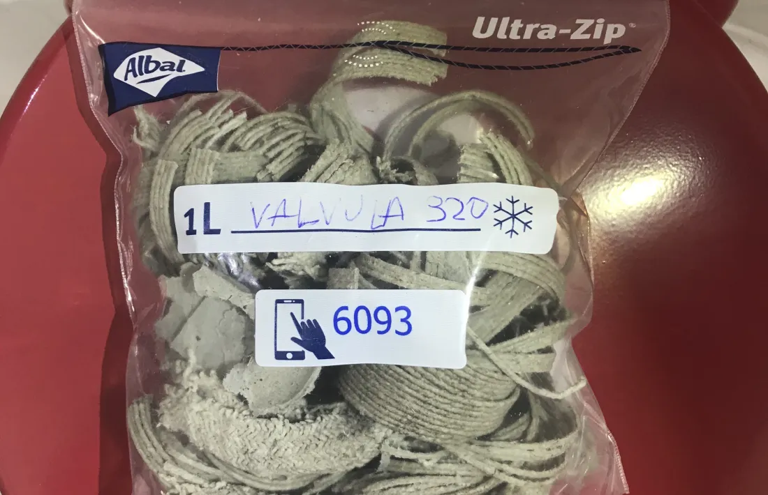 Restes d'amiant extretes d'una de les vàlvules.