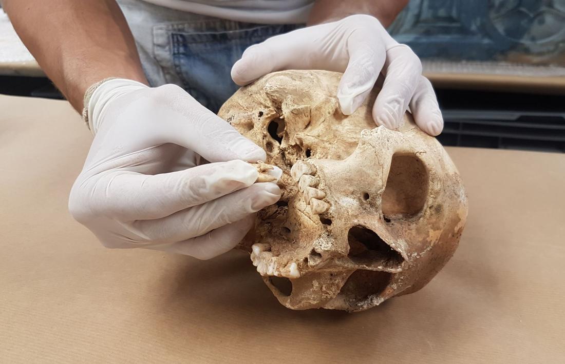 L’arqueòleg Gerard Remolins examina el crani de la dona exhumada a la cista 3 de la Feixa del Moro.