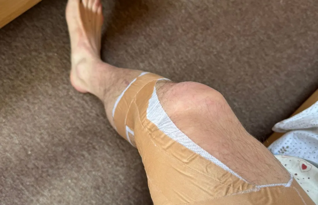 Imatge del genoll de Puig.